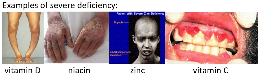 Nutrition and Health