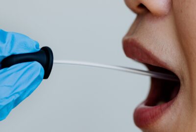 Saliva could help detecting health-related physiologic changes